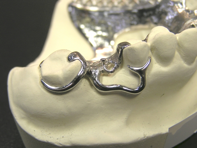 入れ歯の種類は多種多様。保険と自費の違い・見た目や使い心地の特徴を徹底比較します